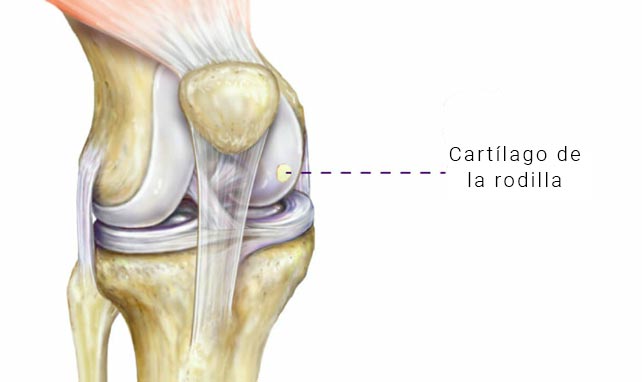 tratamientos lesion cartilago rodilla